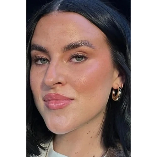 Haus-of-Marin-Lip-filler-Patient-after-image